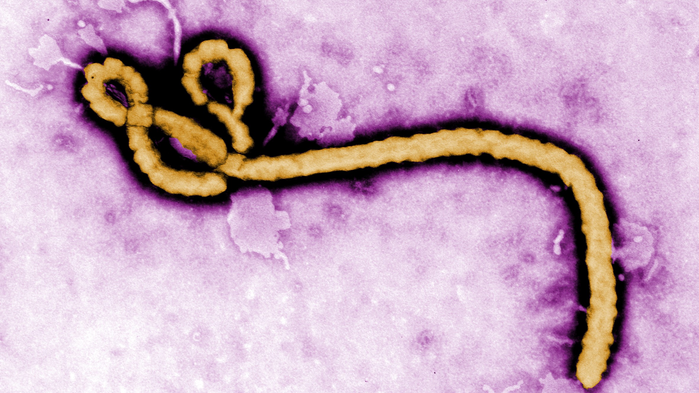 Kongo’da Ebola alarmı: Can kaybı 2 bini aştı